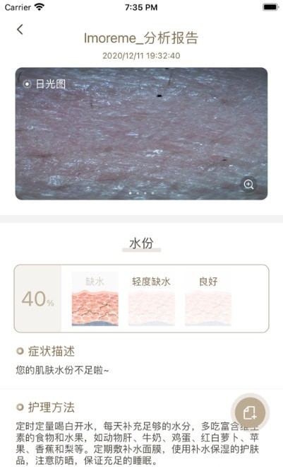 MoreMe水肤镜下载2022安卓最新版最新版